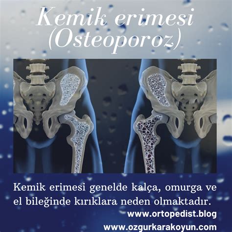 Kuvvet Antrenmanlarının Kemik Sağlığına Katkıları ve Osteoporoz Riskini Azaltma